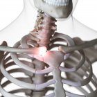 Ilustración digital de la articulación esternoclavicular dolorosa en el esqueleto humano . - foto de stock