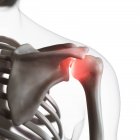 Digital illustration of painful shoulder joint in human skeleton. — Stock Photo