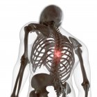 Digital illustration of painful back in human skeleton. — Stock Photo