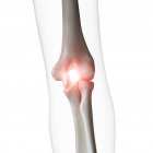 Illustrazione digitale del doloroso gomito nello scheletro umano . — Foto stock
