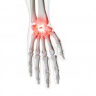 Digitale Darstellung des schmerzhaften Handgelenks im menschlichen Skelett. — Stockfoto
