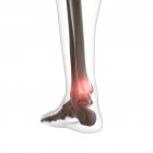 Ilustração digital do tornozelo doloroso no esqueleto humano . — Fotografia de Stock
