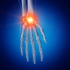 Illustration of painful wrist in human skeleton on blue background. — Stock Photo