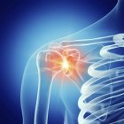 Illustration of painful shoulder joint in human skeleton. — Stock Photo