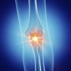 Illustration of painful elbow joint in human skeleton on blue background. — Stock Photo
