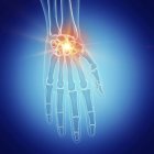 Darstellung des schmerzhaften Handgelenks im menschlichen Skelett auf blauem Hintergrund. — Stockfoto