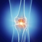 Illustration schmerzhafter Knie im menschlichen Skelett. — Stockfoto