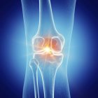 Illustration schmerzhafter Knie im menschlichen Skelett auf blauem Hintergrund. — Stockfoto