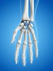 Illustration of wrist replacement on blue background. — Stock Photo