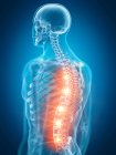 Illustration des schmerzhaften Rückens im menschlichen Skelettteil. — Stockfoto
