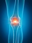 Ілюстрація болючого коліна в частині скелета людини . — стокове фото