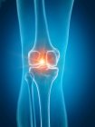 Illustration des schmerzhaften Knies im menschlichen Skelettteil. — Stockfoto