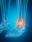 Illustration of painful ankle in human skeleton part. — Stock Photo
