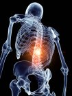 Illustration of painful spine in human skeleton part. — Stock Photo