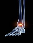 Illustration of painful ankle in human skeleton part. — Stock Photo