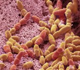 Micrographie électronique à balayage coloré de bactéries anaérobies de Streptococcus mutans dans la flore bactérienne normale de la bouche
. — Photo de stock
