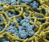 Мікрофотографія бактеріальна культура від мокротиння. — стокове фото