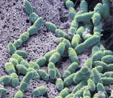 Цветной сканирующий электронный микрограф Streptococcus mutans anaerobic бактерий в нормальной флоре полости рта бактерий . — стоковое фото