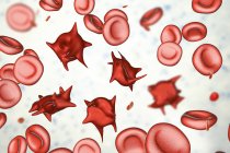 Иллюстрация аномальных красных кровяных телец, известных как акантоциты шпоры . — стоковое фото