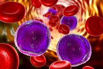 Ilustración digital que muestra células linfoblásticas abundantes en la sangre humana en la leucemia linfoblástica aguda
. - foto de stock