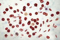 Ilustração digital mostrando glóbulos vermelhos, plaquetas, neutrófilos, monócitos e linfócitos em esfregaço de sangue normal . — Fotografia de Stock