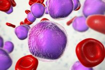 Colored illustration showing abundant lymphoblast cells in human bone marrow smear in acute lymphoblastic leukaemia. — Stock Photo
