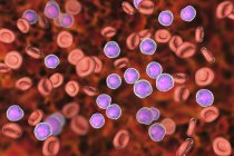 Ilustração colorida mostrando células linfoblásticas abundantes em esfregaço de medula óssea humana em leucemia linfoblástica aguda
. — Fotografia de Stock