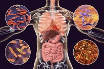 Illustrazione digitale che mostra batteri che causano infezioni dell'apparato respiratorio e digestivo, Mycobacterium tuberculosis, Helicobacter pylori, Salmonella, Shigella . — Foto stock