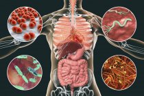 Digital illustration showing bacteria causing infections of respiratory and digestive system, Streptococcus pneumoniae, Helicobacter pylori, Salmonella, Shigella. — Stock Photo