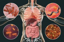 Digital illustration showing bacteria causing infections of respiratory and digestive system, Mycobacterium tuberculosis, Helicobacter pylori, Escherichia coli, Shigella. — Stock Photo