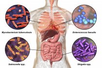 Цифровая иллюстрация, показывающая бактерии, вызывающие инфекции органов дыхания, сердца и пищеварительного тракта, микобактерий туберкулез, энтерококк фекалис, сальмонелла, шигелла
. — стоковое фото