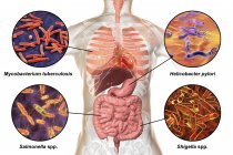 Цифровая маркированная иллюстрация, показывающая бактерии, вызывающие инфекции органов дыхания и пищеварения, микобактерии туберкулеза, Helicobacter pylori, сальмонеллы, Shigella . — стоковое фото