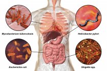 Цифровая маркированная иллюстрация, показывающая бактерии, вызывающие инфекции органов дыхания и пищеварения, микобактерии туберкулеза, Helicobacter pylori, Escherichia coli, Shigella
. — стоковое фото