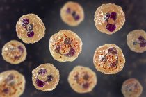 Illustration numérique montrant le liquide céphalorachidien contenant de nombreux neutrophiles atteints de la bactérie Neisseria meningitidis de méningite à méningocoque
. — Photo de stock
