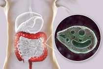 Цифровая иллюстрация, показывающая крупным планом цилийский протозойный кишечный паразит Balantidium coli, вызывающий язвенную болезнь кишечника человека
. — стоковое фото