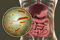 Цифрова ілюстрація, що показує крупним планом бактерії інфекції холери в тонкому кишечнику . — стокове фото
