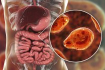 Illustrazione digitale che mostra da vicino il protozoo ciliato Balantidium coli parassita intestinale che causa ulcera della balantidiasi nel tratto intestinale umano . — Foto stock