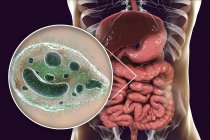 Ilustração digital mostrando close-up do protozoário ciliado Balantidium coli parasita intestinal causando úlcera balantidíase no trato intestinal humano
. — Fotografia de Stock
