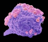Farbige Rasterelektronenmikroskopie der Lymphom-Zelle zeigt frühe apoptotische Veränderungen. — Stockfoto