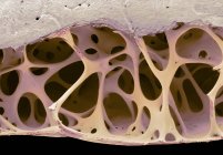 Colored scanning electron micrograph of cancellous bone tissue from starling bird skull. — Stock Photo