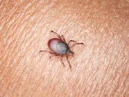 Illustration of tick parasite crawling on human skin surface. — Stock Photo