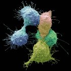 Coloured scanning electron micrograph of ovarian cancer cells. — Stock Photo