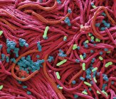 Micrographie électronique à balayage coloré de bactéries cultivées à partir de la surface du téléphone portable . — Photo de stock
