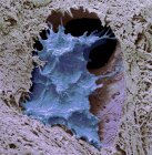 Цветной сканирующий электронный микрограф костной клетки остеоцита, окруженный костной тканью . — стоковое фото