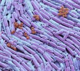 Coloured scanning electron micrograph of bacteria from culture of breast milk. — Stock Photo
