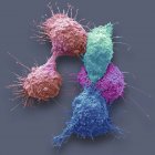 Micrógrafo electrónico de barrido coloreado de células cancerosas de ovario . - foto de stock
