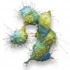 Micrografia eletrônica de varredura colorida de células cancerosas do ovário . — Fotografia de Stock