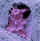 Coloured scanning electron micrograph of osteocyte bone cell surrounded by bone tissue. — Stock Photo