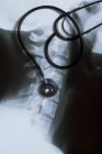 Raio-X do pescoço com estetoscópio, close-up . — Fotografia de Stock