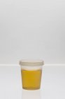 Campione di urina in tazza di plastica su fondo chiaro . — Foto stock